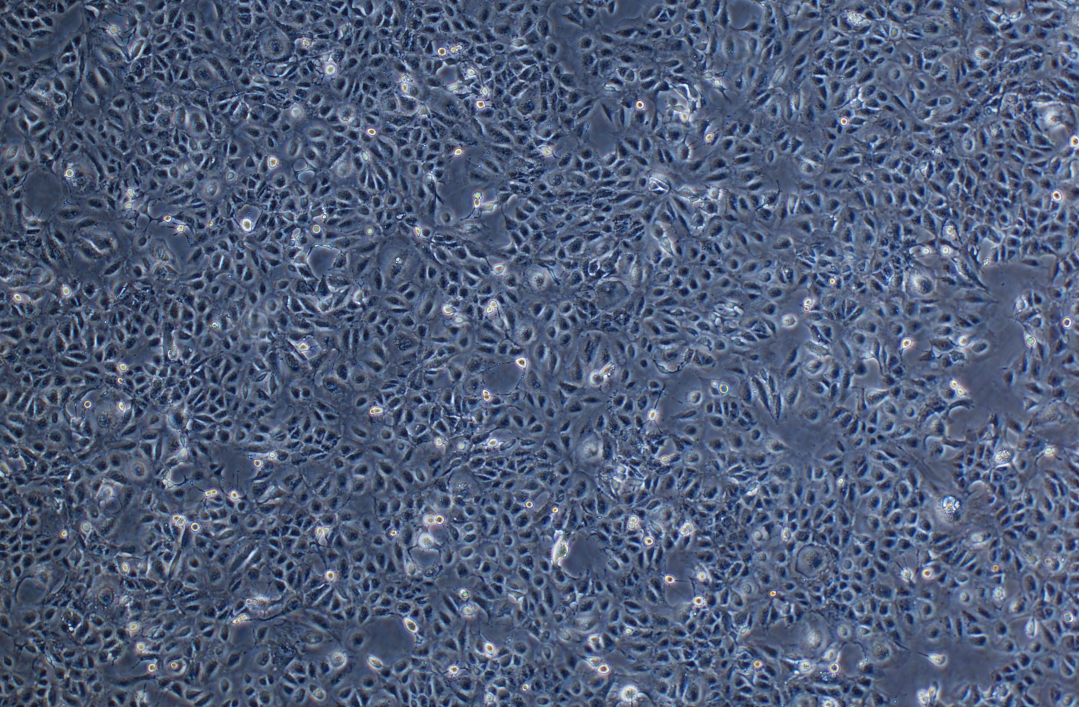 人肺腺癌耐奥希替尼耐药株NCI-H1975+Osimertinib(STR鉴定正确)