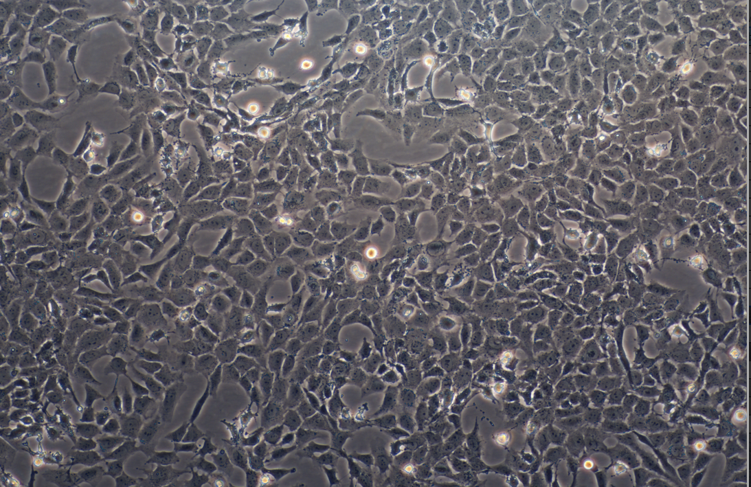 人晶状体上皮细胞HLE-B3(STR鉴定正确)